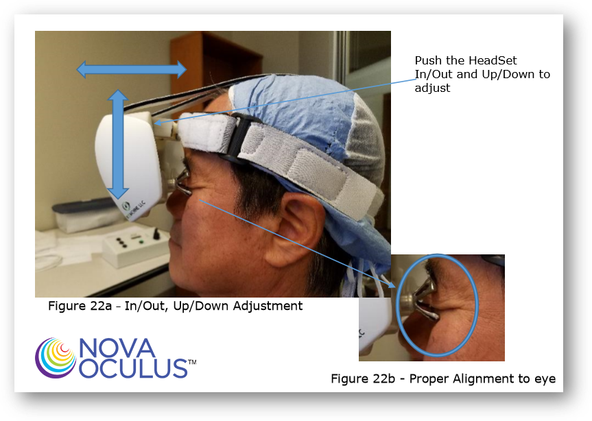 Macular Degeneration Treatment